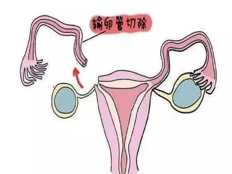 北京指定捐卵，100%可靠，北京正规医院捐卵给多少钱